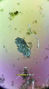 Your Washing Machine Might Be Making You SICK!