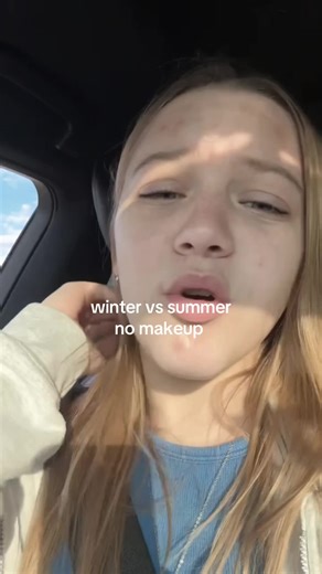 I do have beauty filter on in like 2 winter clips and 1 summer one bc I hate my freckles most the time…(difference is no color in my face, puffy, breaking out, and dull hair)🥀 #chuzz #huzz #winter #summer #trend