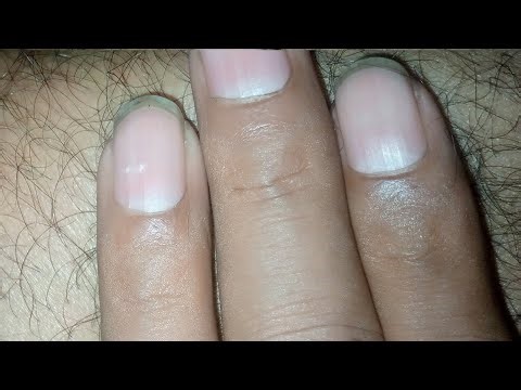 Foot & Calf Massage Technique | Relax Tired Legs & Improve Blood Circulation | Deep Relaxing Massage