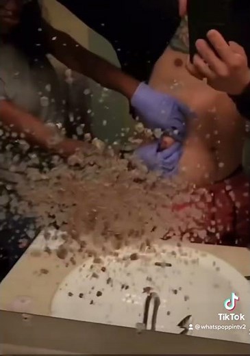 Cyst explosion of pus