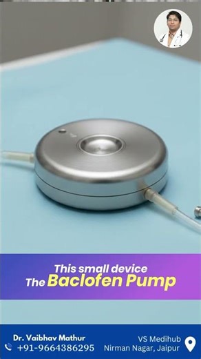 Baclofen Pump: Muscle Stiffness Treatment Explained |