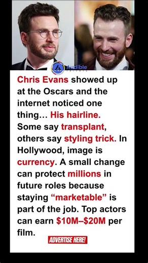 The internet can't get enough of Captain America's 'hairline'