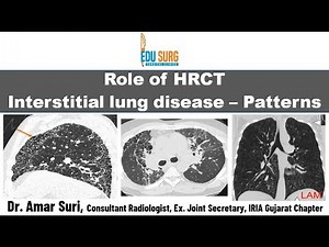 HRCT chest in interstitial lung disease - Chest radiography basics - Classification & patterns