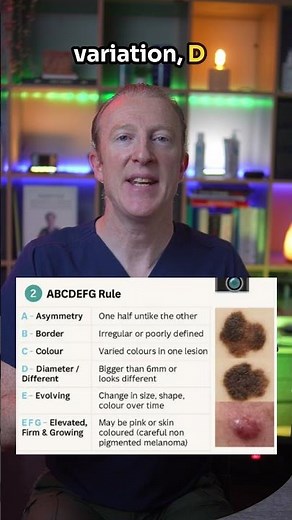 ABCDE rule for mole check. How do I check my moles.
