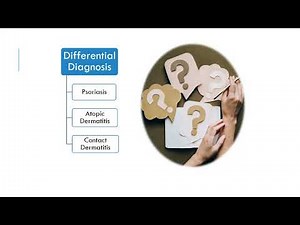 "Pathological Features & Effective Management of Lichen Simplex Chronicus: A Comprehensive Guide"