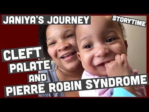 Soft Cleft Palate, Pierre Robin Syndrome, Mickey button feeding tube | Storytime