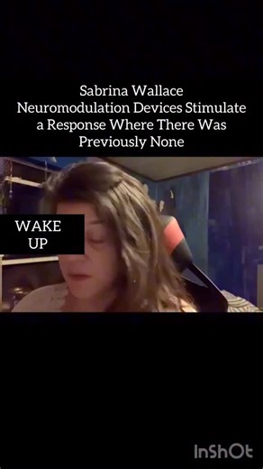 Uncovering Hidden Truths on Instagram: "Neuromodulation works by either actively stimulating nerves to produce a natural biological response or by applying targeted pharmaceutical agents in tiny doses directly to site of action. Neurostimulation devices involve the application of electrodes to the brain, the spinal cord or peripheral nerves. These precisely placed leads connect via an extension cable to a pulse generator and power source, which generates the necessary electrical stimulation. A l