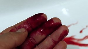 Blood flowing from the cut on the hand after the knife accident,