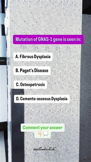 Dr. Pranjali Mandurkar 🔬 on Instagram: "↪️ Mutation of GNAS-1 gene is associated with which condition? 🗝️ Syndromic presentation ➡️ McCune-Albright Syndrome. Can you list out the common triad seen in this syndrome? ⏱️ The severity and range of symptoms depend on when during embryogenesis the mutation arises. Comment your answer 💭👇🏼 . . . . . . #oralpathology #pathology #dental #dentist #pathologist [Oral pathology, Pathology, Dental, Pathologist, Dentist]"