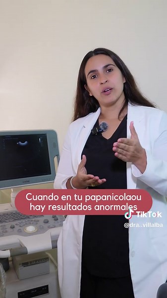 Colposcopia: Lo Que Debes Saber Sobre Este Examen