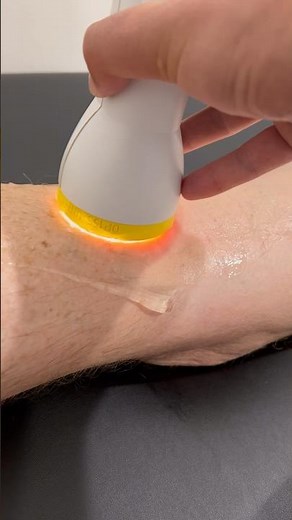 Bakers Cyst, Meniscus Tear and Knee Pain Relief with SoftWave Therapy!