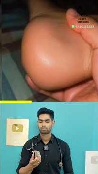 உங்கள் பாதங்களை கவனியுங்கள்! Dr. Isacc Abbas
