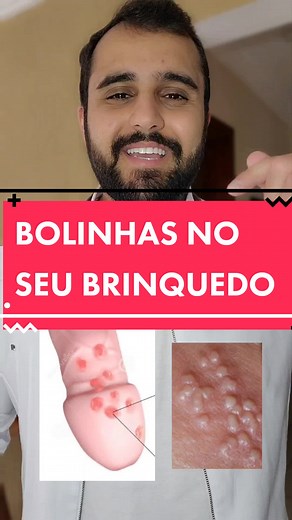 Já conhecia a herpes genital? #herpes #saudedohomem #saude #dicas #curiosidades