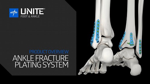 MEDLINEUNITE® Ankle Fracture Plating System Overview