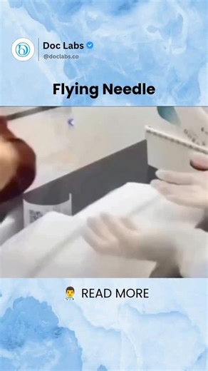 Doc Labs ™ on Instagram: "> The flying needle technique is one of the most practiced and refined methods used by nurses and phlebotomists during venipuncture. 🩸 After locating the vein and inserting the needle at the correct angle, the key step is to stabilize your hand and gently release the needle hub — allowing the needle to “fly” slightly while keeping the holder (or syringe) fixed in place. This simple move prevents unnecessary pressure or movement inside the vein, which means: ✅ Le