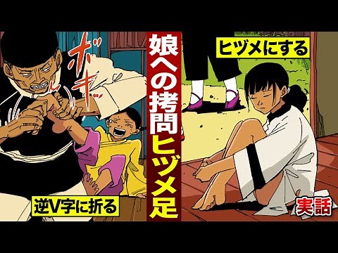【実話】極悪拷問「ヒヅメ足」。少女の足骨を逆V字にヘシ折る。
