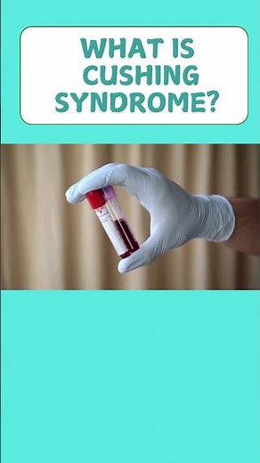 Cushing Syndrome: Symptoms, Causes, and Treatment Explained