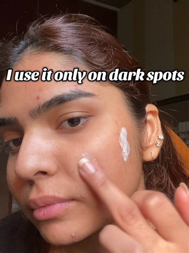 Effective Pigmentation Cream for Dark Spots Treatment
