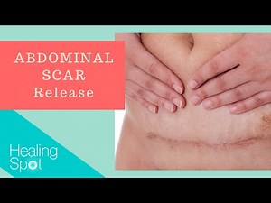 How to Release Abdominal Scars | Justine Calderwood, PT