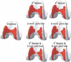 Watch Crepitus online with subtitles in 1080p