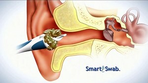 Smart Swab TV Spot, 'Latches On: Masks'