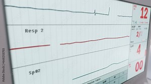 Medical monitoring device analysing the graph of vital pulse markers. Identifying the sudden increase in the vital pulse graph. Vital pulse graph slowly rising after emergency cardiac arrest treatment