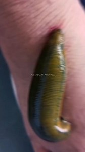 How to Remove a Leech🐛 #leech #worms #bloodsucker #Itchy #insects | All About Animals
