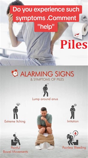 Piles (Hemorrhoids) often start with small signs that many people ignore. 🚨 If you notice pain while passing stool, itching around the anus, swelling, or bright red blood after using the toilet, it could be piles. Some people also feel a small lump around the anus or discomfort when sitting for long. Ignoring these symptoms can make the condition worse and may eventually lead to severe pain or the need for surgery. Early check-up and treatment can help manage piles before it reaches a serious s