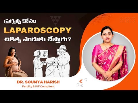 Laparoscopy Treatment for Pregnancy | Laparoscopy Surgery | Infertility Patient | IVF #Fertility