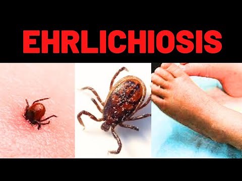 What is Ehrlichiosis? Symptoms, Causes, Treatment