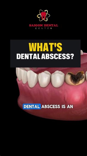 Saigon Center Dental Clinic trên TikTok