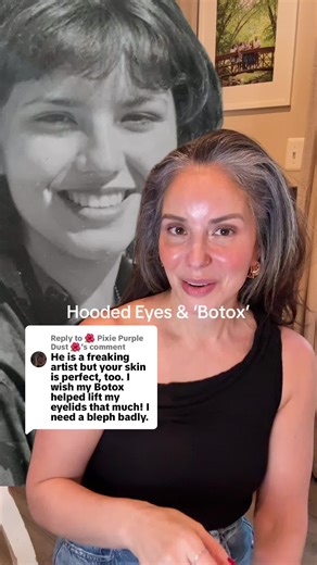 How Botox Changed My Hooded Eyes Experience