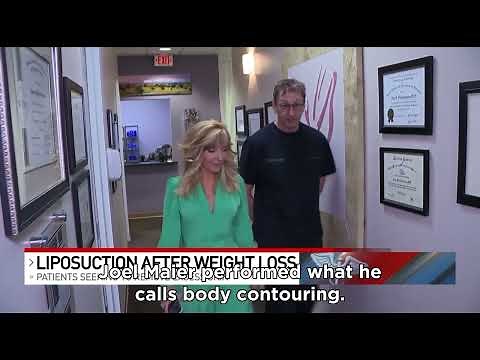 Dramatic Before and After: Liposuction Following Weight Loss!