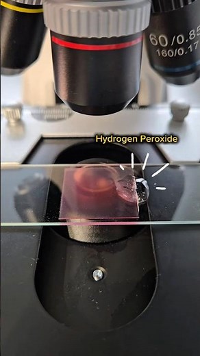 Why Hydrogen Peroxide Makes Blood Stains Disappear 🔬