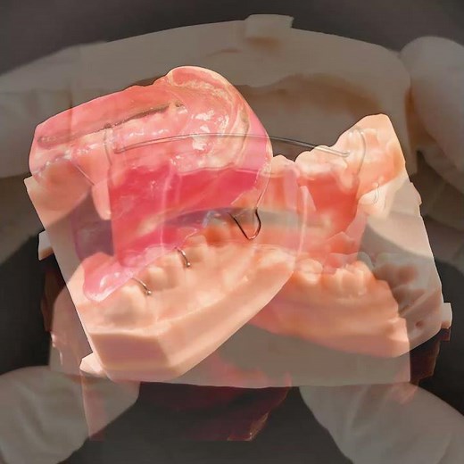 Orthodontic Appliance Activator