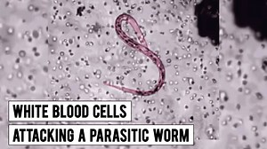 White Blood Cells Attacking a Parasitic Worm This is a time-lapse video of bone marrow–derived eosinophils and a Caenorhabditis Elegans Dauer larva over the course of 80 min. Images were acquired once every 30 s and are displayed at a frame rate of 15/s. This research paper titled 'Leukotriene B4 amplifies eosinophil accumulation in response to nematodes' was published in the Journal of Experimental Medicine. #medicine #medical #parasites #science | SurgMedia