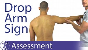 THE DROP ARM SIGN TO DETECT FULL THICKNESS ROTATOR CUFF TEARS The Drop Arm Test or Drop Arm Sign is a very common test that is used in the diagnosis of full thickness rotator cuff tears. But how useful is this test really? Miller et al. (2008) evaluated its diagnostic accuracy and found a sensitivity of 73% and a specificity of 77%. This means that this test only alters the post-test probability to a small degree with a LR of 3.2 and a LR- of 0.34 and a full-thickness tear of the supra- and/or i