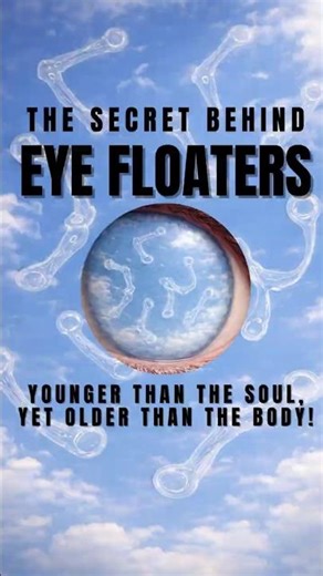 👁️The Secret behind Eye Floaters