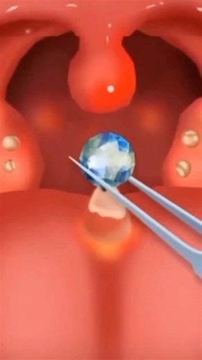 ASMR Piercing Cleaning#animation #cleaning #satisfying #foryou #tiktok #trending #shortvideo #asmr