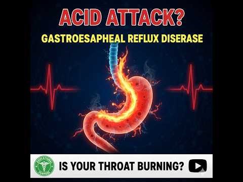 Gastro-esophageal Reflux Diseases