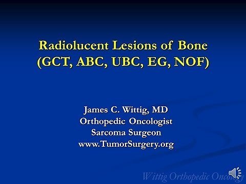 Orthopedic Oncology Course - Radiolucent Lesions of Bone (GCT, ABC, UBC) - Lecture 7