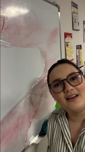 This tip will change the way you use a whiteboard! 🧽😱