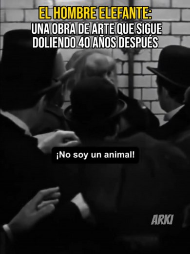 El Hombre Elefante: película basada en Joseph Merrick (síndrome de Proteus)