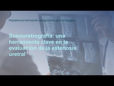 932. Sonourethrography: a key tool in the evaluation of urethral stricture