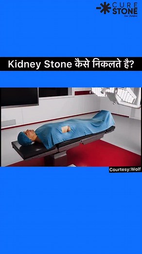 🎥 Mini Perc — the revolution in kidney stone surgery! No big cuts. No long hospital stay. Just a pin-hole and precision laser that clears even large stones in minutes. 💎 Watch this 3D animation to see how Dr Deepanshu Gupta performs Mini Perc with cutting-edge technology at CureStone, giving patients zero-pain recovery. 👉 Tag someone suffering from kidney stones — this could change their life. 👨‍⚕️ Follow @the_cure_stone for more real surgeries, animations & kidney-care tips! #MiniPerc #Kidn