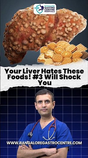 Your Liver Hates These Foods! #3 Is Destroying Indian Livers Daily!