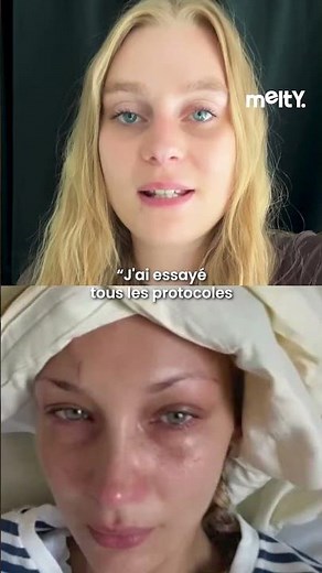 Bella Hadid desperate due to Lyme disease!