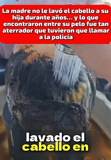 Una niña de 9 años llevaba años sin que le lavaran el cabello. Siempre usaba el mismo moño apretado... hasta que un día se desmayó y terminó en el hospital. Lo que los médicos encontraron dentro de su cabello dejó a todos sin palabras. La policía tuvo que intervenir #learnontiktok #truestory #storytime #historiareal