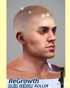 𝑳𝒋𝒆𝒕𝒏𝒂 𝑹𝒂𝒔𝒑𝒓𝒐𝒅𝒂𝒋𝒂 𝒁𝒂𝒍𝒊𝒉𝒂☀️ HAIRBACK 𝐬𝐚𝐝 𝐳𝐚 𝐬𝐚𝐦𝐨 ⮞ 79.00 kn Kliknite za detalje👇 https://superzebra.hr/proizvod/serum-za-kosu-hairback-u-obliku-rolera/?sp=7779i007 | Superzebra