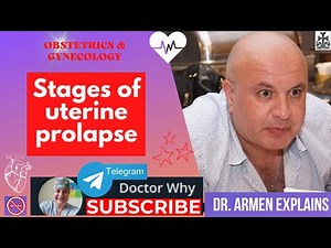 Uterine Prolapse: From Diagnosis to Management - The 16 Minute Guide